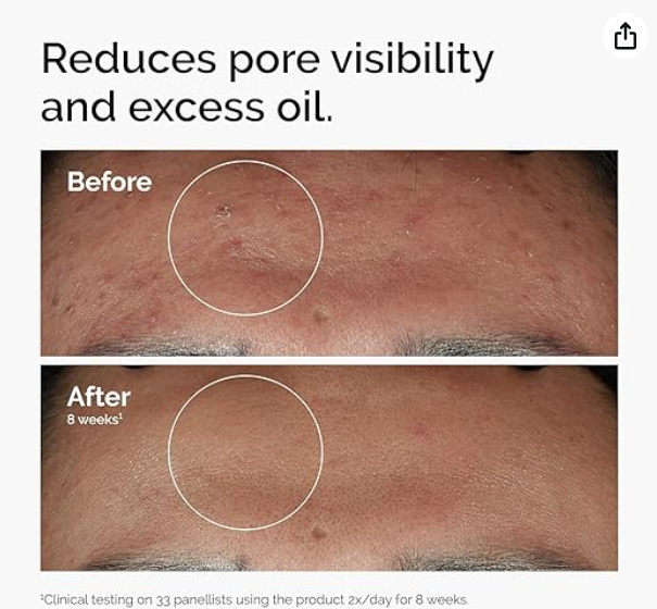 Niacinamide 10% + Zinc 1% Serum (Original)