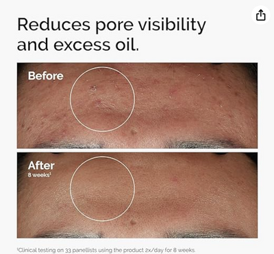 Niacinamide 10% + Zinc 1% Serum (Original)